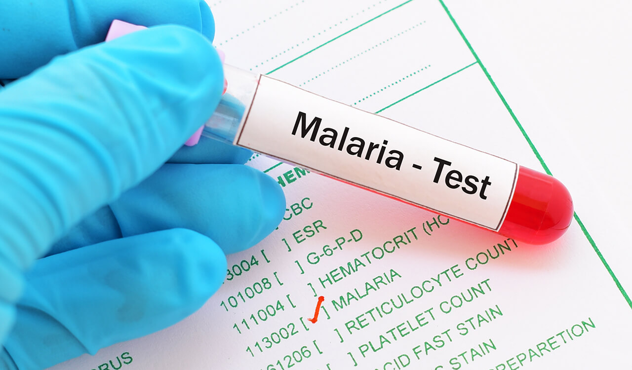 Moçambique Entre os Cinco Países Que Mais Contribuíram Para os Casos Globais de Malária em 2024 • Diário Económico